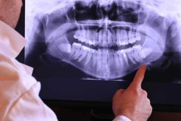 Best Emergency Tooth Extraction in Peosta, IA